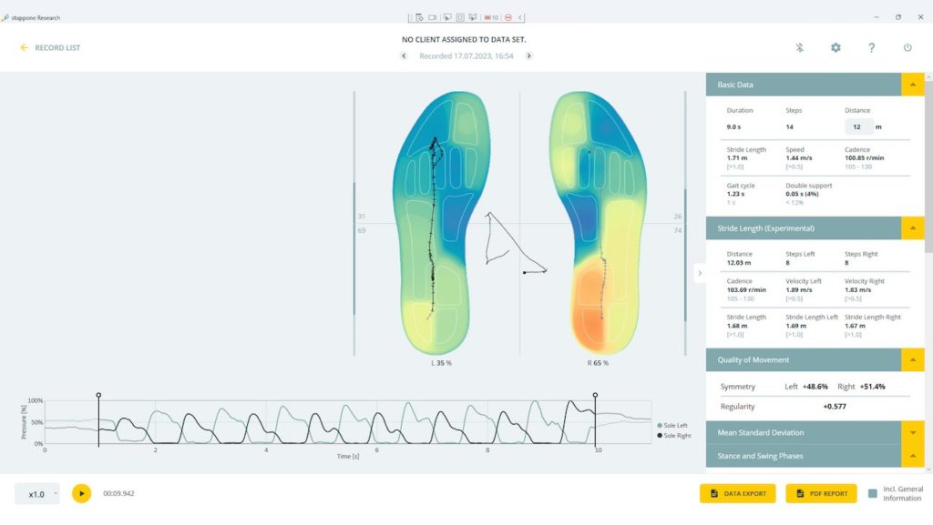 Objective measurements with stappone software